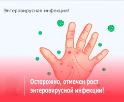 Профилактика энтеровирусной инфекции Профилактика энтеровирусной инфекции.